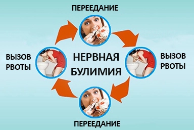 Лечение булимии в Заполярном